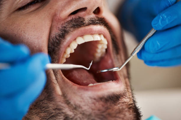 Tooth Infection Emergency Dentist in DE